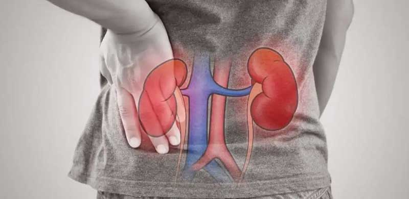 Acute kidney Injury